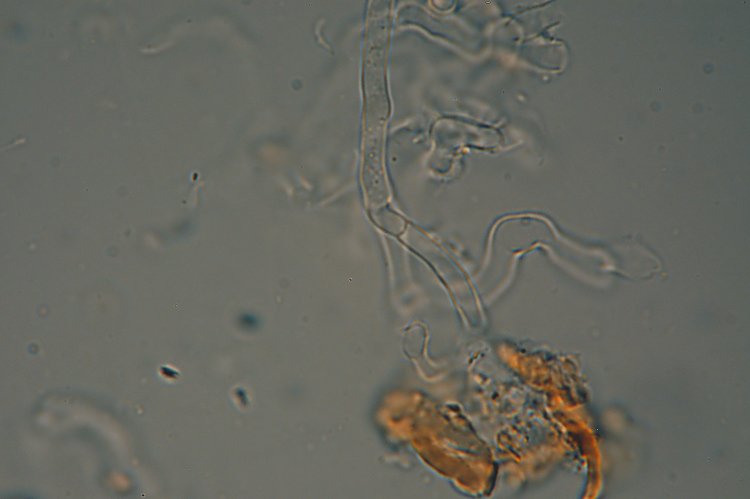 Un Phanerochaete da determinare (Hyphodermella corrugata)